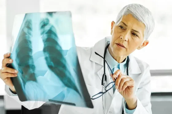 DMD Hastalığı Nedir?